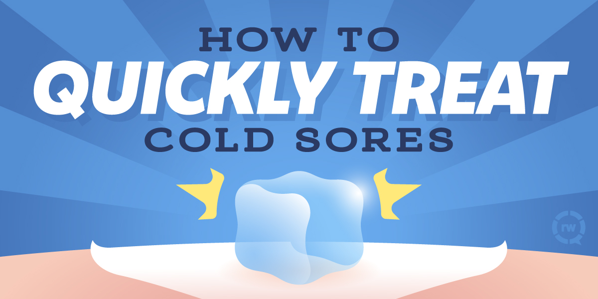 treat-cold-sores